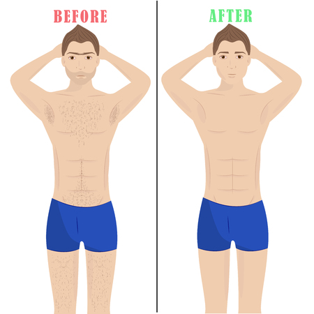 Area bikini foto epilation prima e dopo